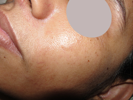 Dr Pandya Clinic Udaipur